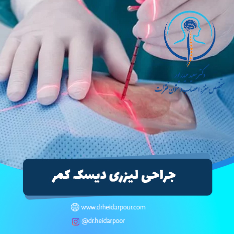 جراحی لیزری دیسک کمر در مشهد
