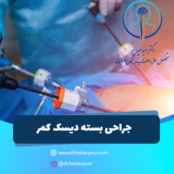 جراحی بسته (اندوسکوپیک) دیسک کمر مشهد